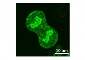 核膜を染色した細胞分裂中のヒト培養細胞